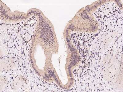 Immunohistochemistry-Paraffin: ZNF879 Antibody [NBP2-98028]