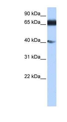 Western Blot: ZNF879 Antibody [NBP1-91424]