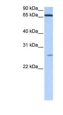 Western Blot: ZNF879 Antibody [NBP1-91425]