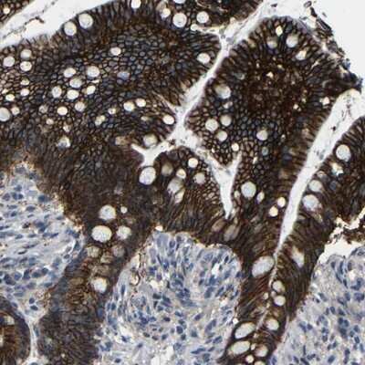 Immunohistochemistry-Paraffin: ZNF90 Antibody [NBP1-93683]