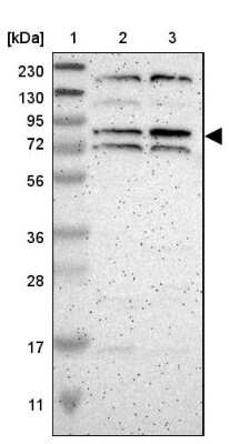 Western Blot: ZNF90 Antibody [NBP1-93683]