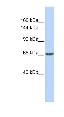 Western Blot: ZNF91 Antibody [NBP1-79225]