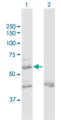 Western Blot: ZNF92 Antibody [H00168374-D01P]