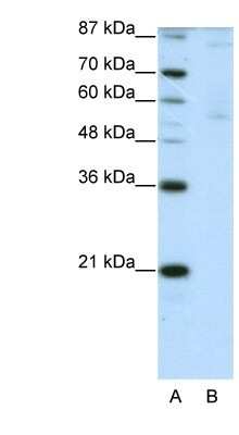 Western Blot: ZNF92 Antibody [NBP1-80415]