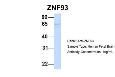 Western Blot: ZNF93 Antibody [NBP1-79260]