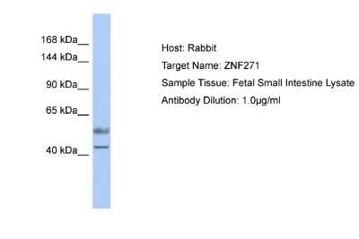 Western Blot: ZNF93 Antibody [NBP2-84367]