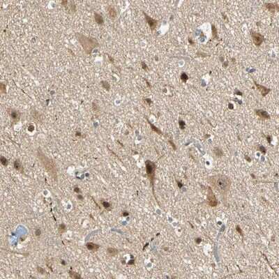 Immunohistochemistry-Paraffin: ZNF96 Antibody [NBP1-88018]