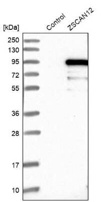 Western Blot: ZNF96 Antibody [NBP1-88018]