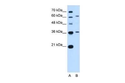 Western Blot: ZNF96 Antibody [NBP2-86563]