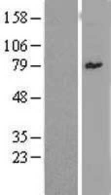 Western Blot: ZNF96 Overexpression Lysate [NBL1-18267]