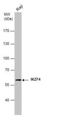 Western Blot: ZNFN1A4 Antibody (GT976) [NBP3-13498]