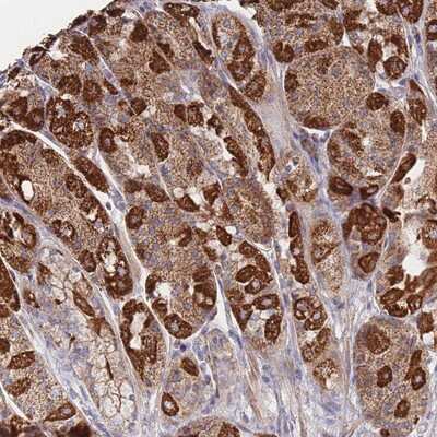 Immunohistochemistry-Paraffin: ZNFN1A4 Antibody [NBP2-14120]