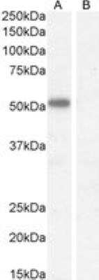 Western Blot: ZNFN1A4 Antibody [NBP3-12160]