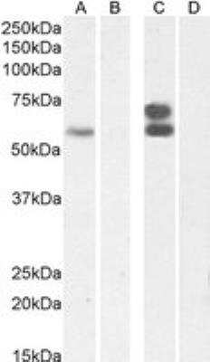 Western Blot: ZNFN1A4 Antibody [NBP3-12160]