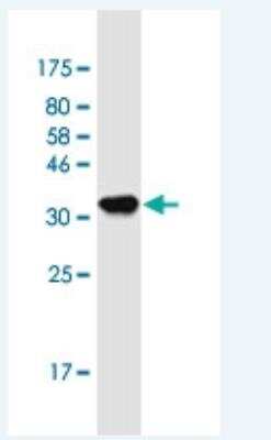 Western Blot: ZNFX1 Antibody (6F9) [H00057169-M02-100ug]