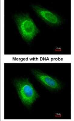 Immunocytochemistry/ Immunofluorescence: ZNHIT1 Antibody [NBP1-33372]