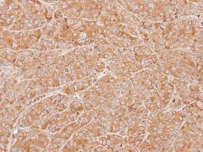 Immunohistochemistry-Paraffin: ZNHIT1 Antibody [NBP1-33372]