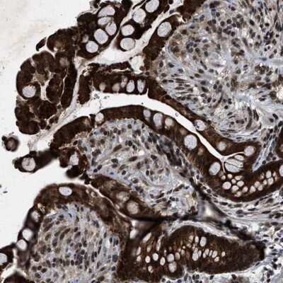 Immunohistochemistry-Paraffin: ZNHIT1 Antibody [NBP1-85673]