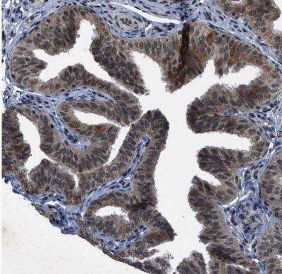 Immunohistochemistry-Paraffin: ZNHIT1 Antibody [NBP1-85673]