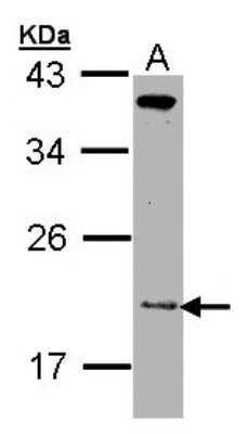 Western Blot: ZNHIT1 Antibody [NBP1-33372]