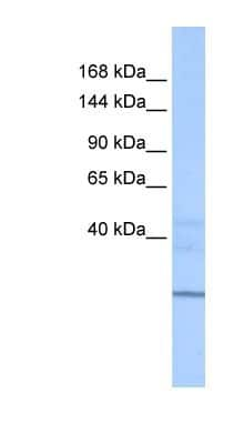 Western Blot: ZNHIT1 Antibody [NBP1-79374]