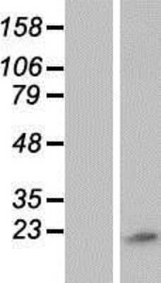 Western Blot: ZNHIT1 Overexpression Lysate [NBP2-07634]