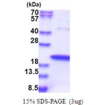 SDS-PAGE: Recombinant Human ZNHIT1 His Protein [NBP2-51640]