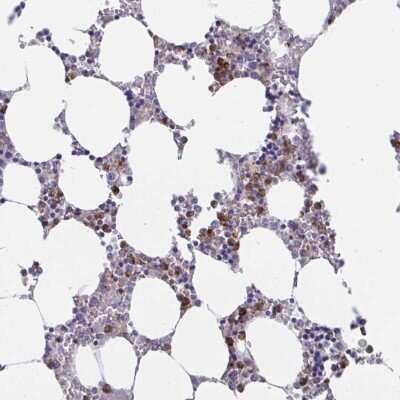 Immunohistochemistry-Paraffin: ZNHIT2 Antibody [NBP2-34096]