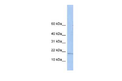 Western Blot: ZNHIT3 Antibody [NBP2-86564]