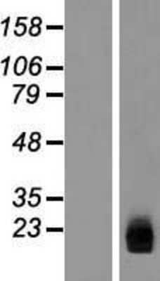 Western Blot: ZNHIT3 Overexpression Lysate [NBL1-18259]