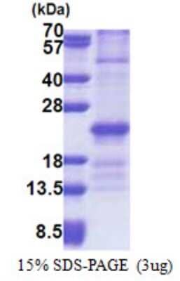 SDS-PAGE: Recombinant Human ZNHIT3 His Protein [NBP2-22961]