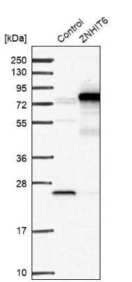 Western Blot: ZNHIT6 Antibody [NBP1-88683]