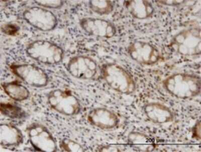 Immunohistochemistry-Paraffin: ZNRF1 Antibody (1H4) [H00084937-M01]