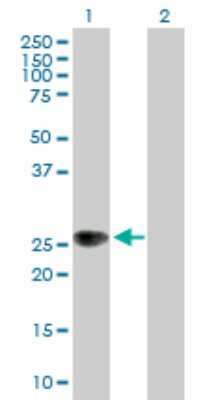 Western Blot: ZNRF1 Antibody [H00084937-B01P]