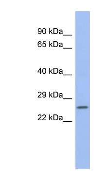 Western Blot: ZNRF1 Antibody [NBP1-80377]