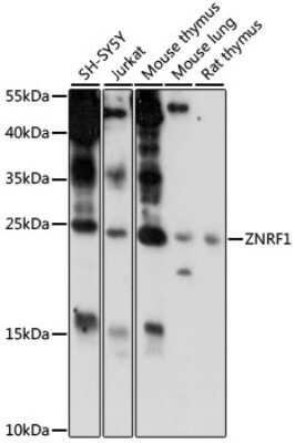 Western Blot: ZNRF1 AntibodyAzide and BSA Free [NBP2-94411]