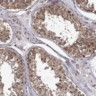 Immunohistochemistry: ZNRF2 Antibody [NBP2-68934]