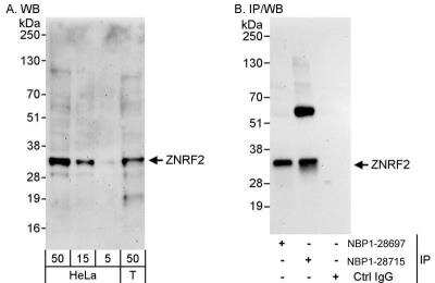 Western Blot: ZNRF2 Antibody [NBP1-28715]