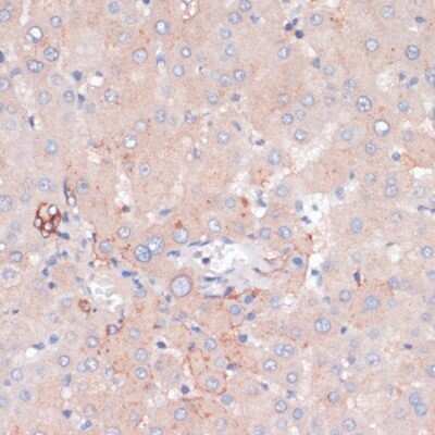 Immunohistochemistry-Paraffin: ZNRF3 Antibody - Azide and BSA Free [NBP3-03924]