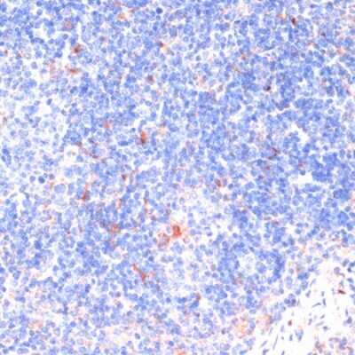 Immunohistochemistry-Paraffin: ZNRF3 Antibody - Azide and BSA Free [NBP3-03924]