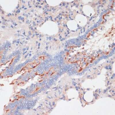 Immunohistochemistry-Paraffin: ZNRF3 Antibody - Azide and BSA Free [NBP3-03924]