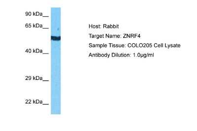 Western Blot: ZNRF4 Antibody [NBP2-86923]