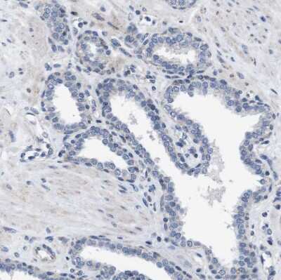 Immunohistochemistry-Paraffin: ZP2 Antibody [NBP1-86103]