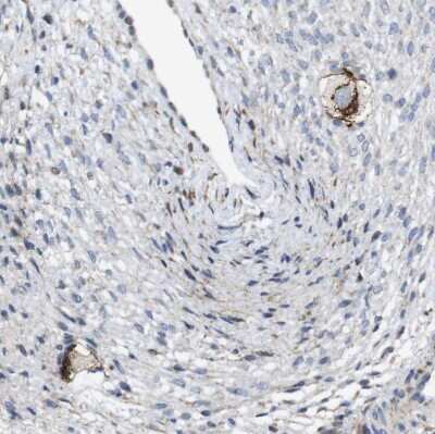 Immunohistochemistry-Paraffin: ZP2 Antibody [NBP1-86103]