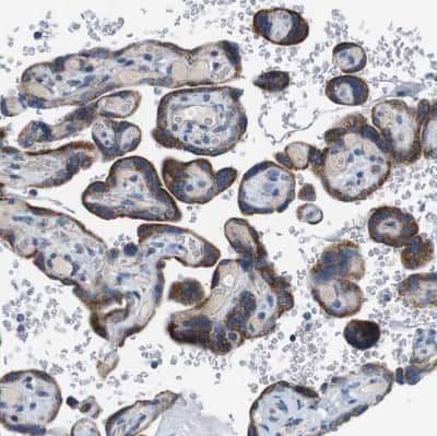 Immunohistochemistry-Paraffin: ZP2 Antibody [NBP1-86103]