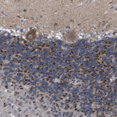 Immunohistochemistry-Paraffin: ZP2 Antibody [NBP1-86103]