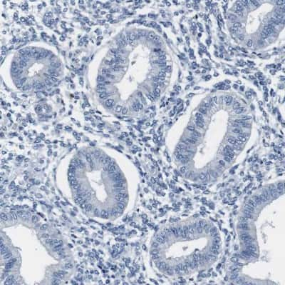 Immunohistochemistry-Paraffin: ZP2 Antibody [NBP1-86103]