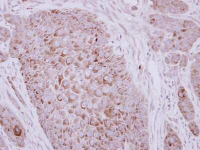 Immunohistochemistry-Paraffin: ZP2 Antibody [NBP2-21053]