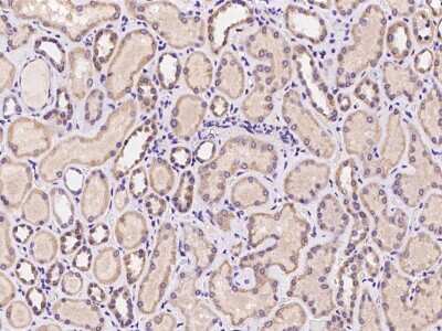 Immunohistochemistry-Paraffin: ZP2 Antibody [NBP2-97981]