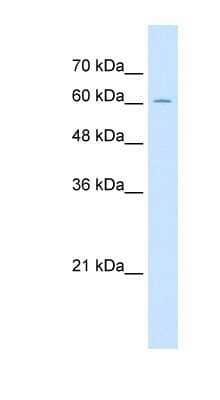 Western Blot: ZP2 Antibody [NBP1-59436]